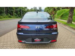 HYUNDAI - HB20S - 2020/2021 - Azul - R$ 77.500,00